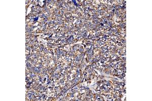 IHC analysis of PMPCA/INPP5 using anti-PMPCA/INPP5 antibody (ABIN7602722). (PMPCA anticorps  (AA 99-525))