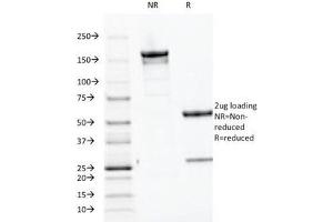 SDS-PAGE Analysis of Purified, BSA-Free Parathyroid Hormone Antibody (clone PTH/1174). (PTH anticorps  (AA 32-115))