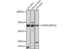 Western blot analysis of extracts of various cell lines, using CRMP5/DPYSL5 Rabbit mAb (ABIN7266774) at 1:1000 dilution. (DPYSL5 anticorps)