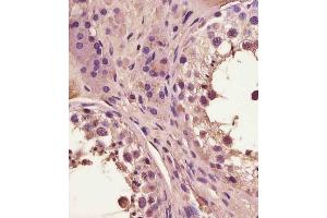 (ABIN6243665 and ABIN6578886) staining FA in human testis tissue sections by Immunohistochemistry (IHC-P - paraformaldehyde-fixed, paraffin-embedded sections). (FAM3A anticorps  (AA 201-230))