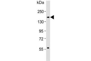 Western blot testing of human spleen lysate with CD11b antibody.