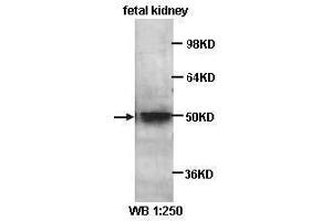 Western Blotting (WB) image for anti-Kruppel-Like Factor 8 (KLF8) antibody (ABIN1856579) (KLF8 anticorps)