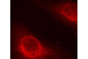 Immunofluorescence analysis of methanol-fixed HeLa cells using Phospho-CFL1(S3) Polyclonal Antibody (Cofilin anticorps  (pSer3))