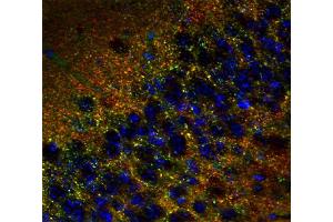 Immunohistochemistry (IHC) image for anti-Tumor Protein P63 Regulated 1-Like (TPRG1L) antibody (ABIN1742502)