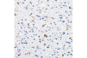 Immunohistochemistry of paraffin-embedded Human brain using CD74 antibody (ABIN6128421, ABIN6138228, ABIN6138230 and ABIN6221316) at dilution of 1:25 (40x lens).