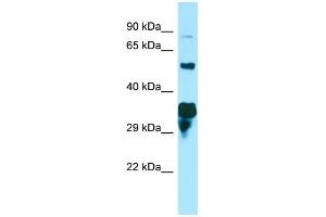 WB Suggested Anti-SPG21 Antibody Titration: 1. (SPG21 anticorps  (C-Term))