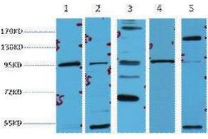 Western Blotting (WB) image for anti-Catenin, beta (CATNB) antibody (ABIN3178618) (beta Catenin anticorps)