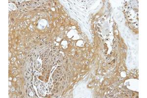 IHC-P Image Immunohistochemical analysis of paraffin-embedded Cal27 xenograft, using EIF3K, antibody at 1:100 dilution. (EIF3K anticorps)