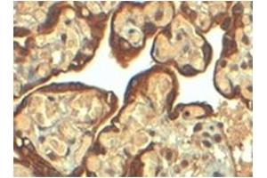 Image no. 3 for anti-Plasminogen Activator Inhibitor 1 (SERPINE1) (Internal Region) antibody (ABIN374547) (PAI1 anticorps  (Internal Region))
