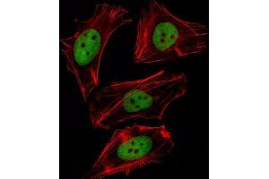 Immunofluorescence (IF) image for anti-Forkhead Box D1 (FOXD1) antibody (ABIN2997954) (FOXD1 anticorps)