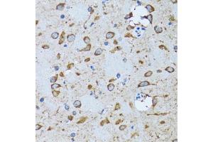 Immunohistochemistry of paraffin-embedded mouse brain using PDP1 antibody (ABIN6132860, ABIN6145404, ABIN6145405 and ABIN6221944) at dilution of 1:100 (40x lens).