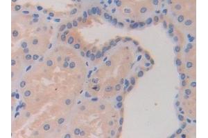 Detection of HDAC6 in Human Kidney Tissue using Polyclonal Antibody to Histone Deacetylase 6 (HDAC6)