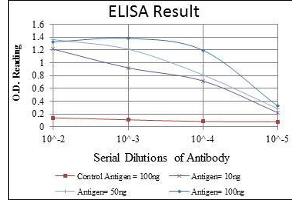 Red: Control Antigen (100 ng), Purple: Antigen (10 ng), Green: Antigen (50 ng), Blue: Antigen (100 ng), (CCT2 anticorps)