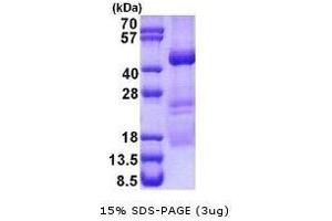 Figure annotation denotes ug of protein loaded and % gel used. (XPA Protéine)