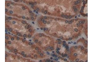 Detection of ACP in Human Kidney Tissue using Polyclonal Antibody to Acyl Carrier Protein, Mitochondrial (ACP)