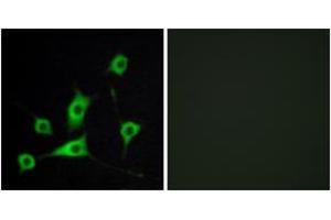 Immunofluorescence analysis of LOVO cells, using CRBP III Antibody. (Retinol Binding Protein 5 anticorps  (AA 10-59))