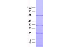 Validation with Western Blot