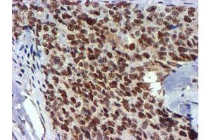 Image no. 10 for anti-Ubiquitin Specific Peptidase 7 (Herpes Virus-Associated) (USP7) antibody (ABIN1498592) (USP7 anticorps)