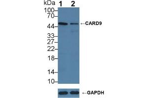 Knockout Varification: Lane 1: Wild-type PC3 cell lysate, Lane 2: CARD9 knockout PC3 cell lysate, Predicted MW: 62,56,43kd Observed MW: 50kd Primary Ab: 3 μg/mL Rabbit Anti-Human CARD9 Antibody Second Ab: 0.