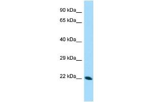 WB Suggested Anti-CDNF Antibody Titration: 1. (CDNF anticorps  (N-Term))
