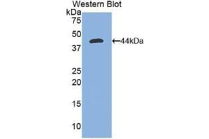 Western blot analysis of the recombinant protein. (Nephrin anticorps  (AA 39-106))
