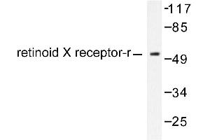 Image no. 1 for anti-Retinoid X Receptor, gamma (RXRG) antibody (ABIN271807) (Retinoid X Receptor gamma anticorps)