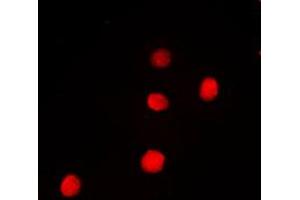 Immunofluorescent analysis of PAX9 staining in Jurkat cells. (PAX9 anticorps  (Center))