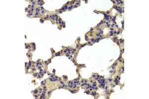 Immunohistochemistry of paraffin-embedded Rat lung using HDAC7 antibody at dilution of 1:100 (x400 lens). (HDAC7 anticorps)