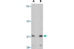 Western blot analysis of FBXL20 in A-20 cell lysate with FBXL20 polyclonal antibody  at (A) 0. (FBXL20 anticorps  (N-Term))