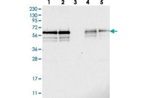 Western blot analysis of Lane 1: RT-4, Lane 2: U-251 MG, Lane 3: Human Plasma, Lane 4: Liver, Lane 5: Tonsil with BSDC1 polyclonal antibody  at 1:250-1:500 dilution. (BSDC1 anticorps)