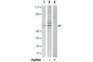 Western blot analysis of extracts from HepG2 cells (Lane 1 and 3) and 293 cells (Lane 2), using DAB1 polyclonal antibody . (DAB1 anticorps)