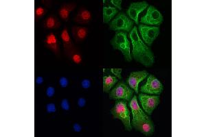 ABIN6265927 and ABIN6273024 staining Hela cells by IF/ICC.