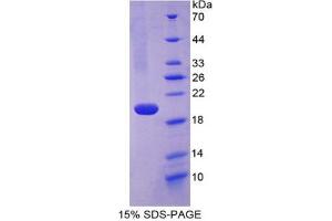 SDS-PAGE analysis of Human Fibulin 5 Protein. (Fibulin 5 Protein (FBLN5))