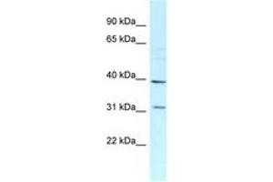 Image no. 1 for anti-Mitochondrial Ribosomal Protein L46 (MRPL46) (C-Term) antibody (ABIN6747859)
