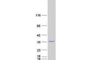 Validation with Western Blot
