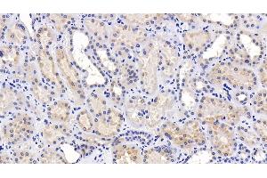 Detection of LAMP2 in Human Kidney Tissue using Polyclonal Antibody to Lysosomal Associated Membrane Protein 2 (LAMP2)