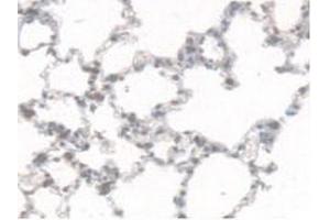 Detection of CES1 in Rat Lung Tissue using Polyclonal Antibody to Carboxylesterase 1 (CES1)