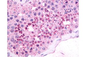 Anti-NMBR antibody IHC of human testis. (NMBR anticorps  (Cytoplasmic Domain))