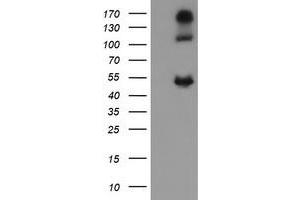 Image no. 2 for anti-Carbonic Anhydrase 12 (CA12) antibody (ABIN1497065) (CA12 anticorps)
