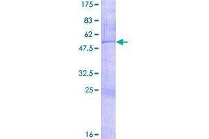 Image no. 1 for Zinc Finger Protein 266 (ZNF266) (AA 1-263) protein (GST tag) (ABIN1326047)
