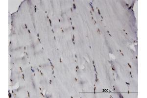 anti-RCSD Domain Containing 1 (RCSD1) (AA 181-289) antibody