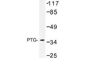 Image no. 1 for anti-Protein Phosphatase 1, Regulatory Subunit 3C (PPP1R3C) antibody (ABIN317934) (PPP1R3C anticorps)