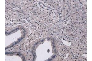 IHC-P analysis of Mouse Uterus Tissue, with DAB staining. (MUC5B anticorps  (AA 75-295))