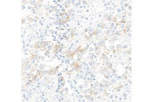 Immunohistochemistry (IHC) image for anti-Mast/stem Cell Growth Factor Receptor (KIT) (AA 325-375) antibody (ABIN7795658) (Recombinant KIT anticorps  (AA 325-375))