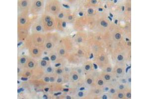 IHC-P analysis of liver tissue, with DAB staining. (CMTM8 anticorps  (AA 1-173))