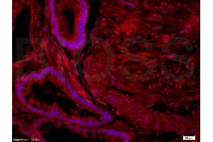 Formalin-fixed and paraffin embedded human placenta tissue labeled with Rabbit Anti-Nociceptin receptor Polyclonal Antibody (ABIN725960) at 1:200 followed by conjugation to the secondary antibody and DAPI staining. (OPRL1 anticorps  (AA 1-47))
