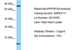 Western Blotting (WB) image for anti-Protein Phosphatase 1, Regulatory (Inhibitor) Subunit 15A (PPP1R15A) (N-Term) antibody (ABIN971447) (GADD34 anticorps  (N-Term))