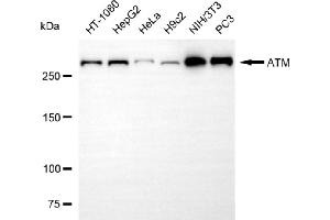 Western blotting analysis using ATM antibody (ABIN7797667).