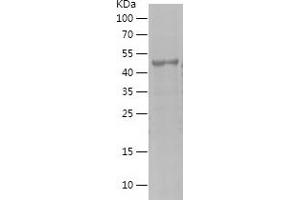 Western Blotting (WB) image for Melanoma Antigen Family A, 1 (Directs Expression of Antigen MZ2-E) (MAGEA1) (AA 161-309) protein (His-IF2DI Tag) (ABIN7123882)