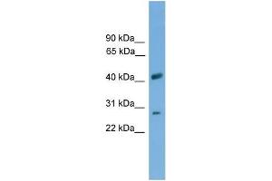 Human THP-1; WB Suggested Anti-SLC25A37 Antibody Titration: 0. (SLC25A37 anticorps  (C-Term))